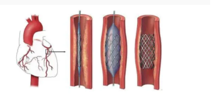 QQ截图20220601161341