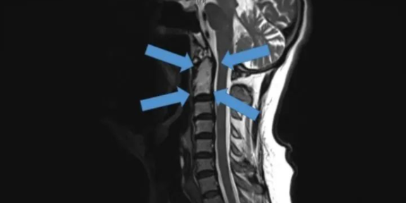 QQ截图20220617093413